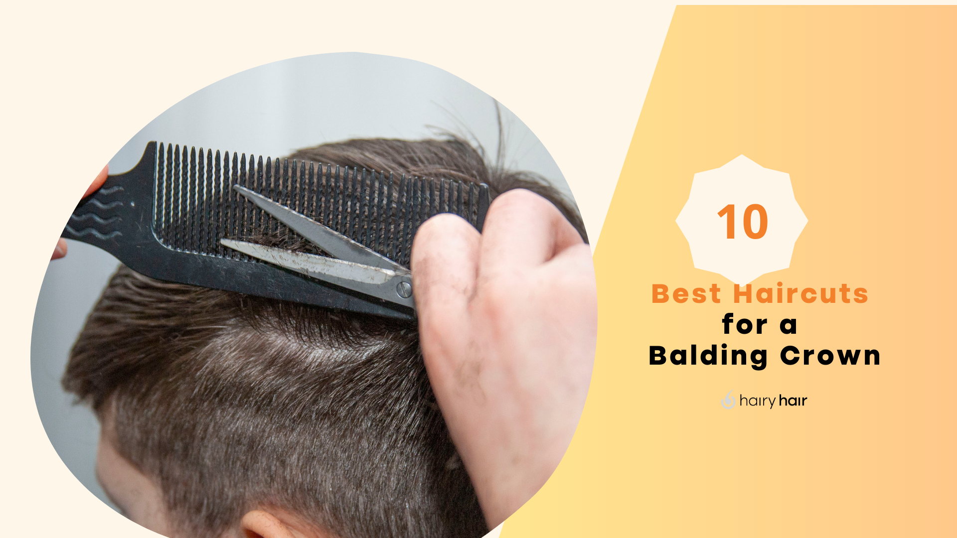 10 Best Haircuts for a Balding Crown
