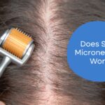 Can Scalp Microneedling Regrow Your Hair?