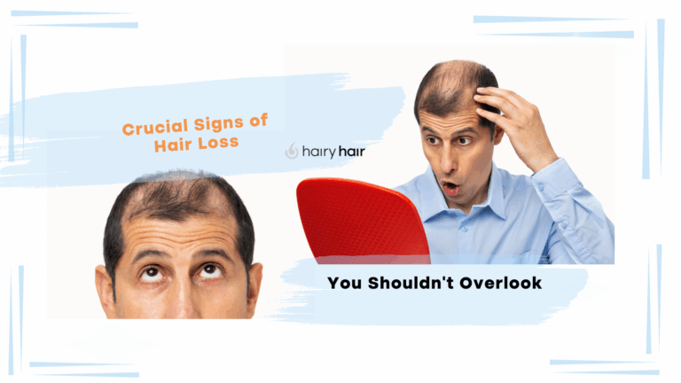 Crucial Signs of Hair Loss You Shouldn’t Overlook