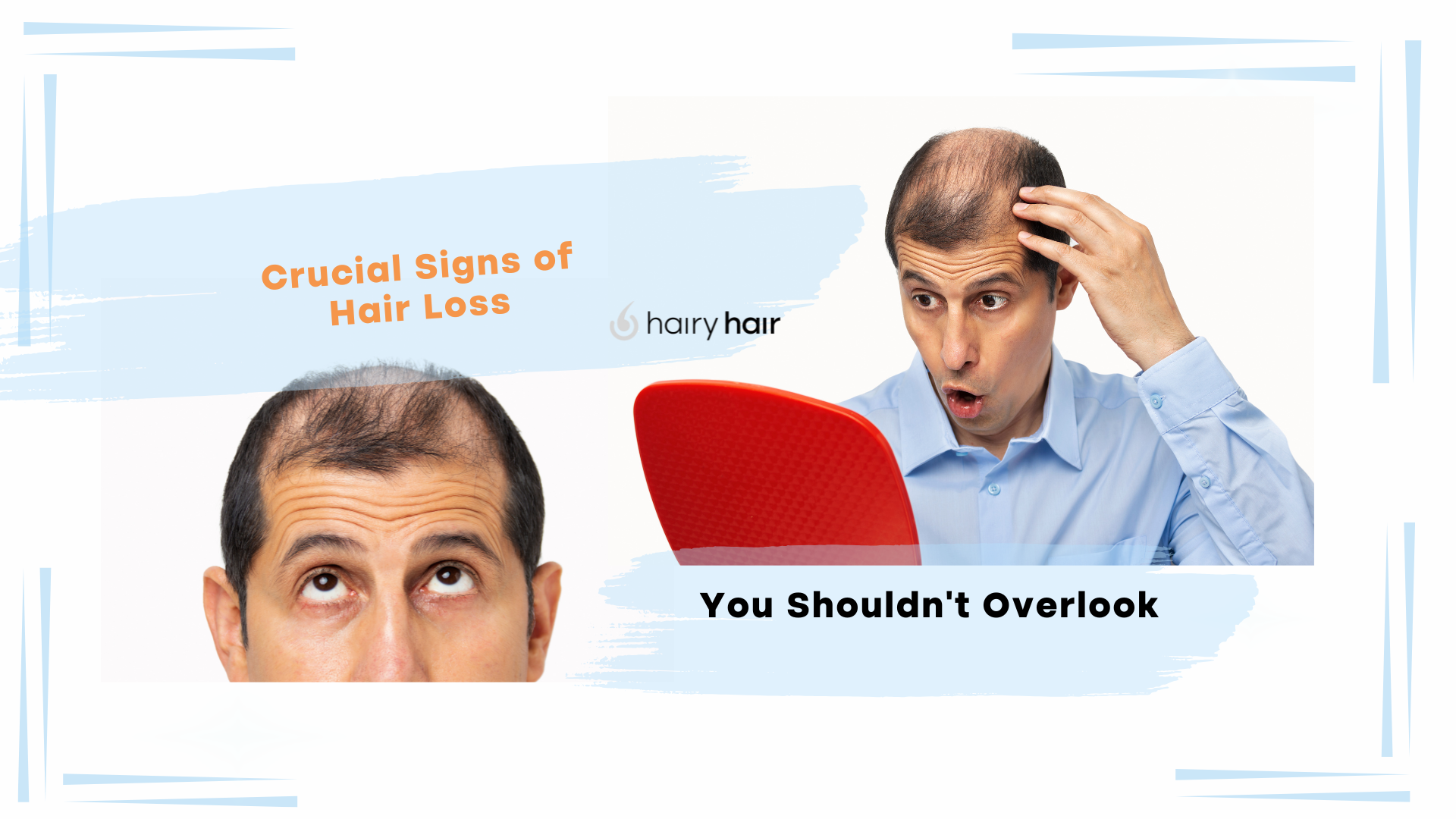 Crucial Signs of Hair Loss You Shouldn’t Overlook