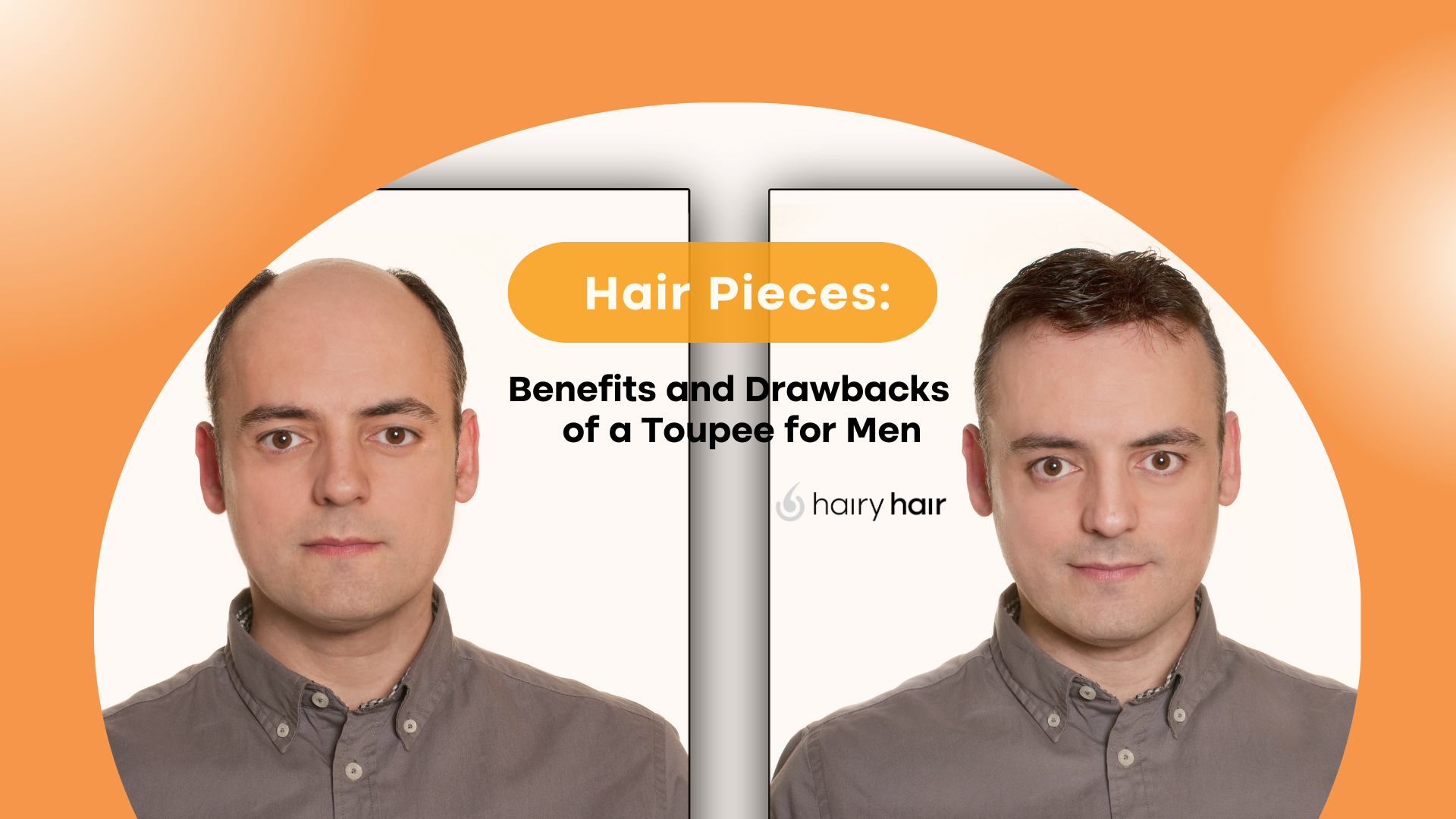 Hair Pieces: Benefits and Drawbacks of a Toupee for Men