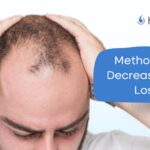 How To Decrease Hair Loss