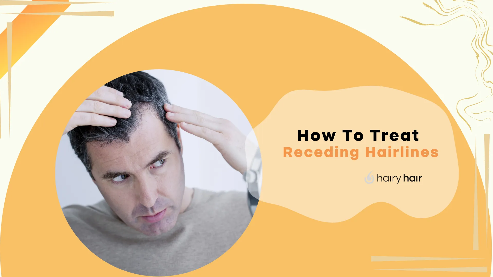 How To Treat Receding Hairlines