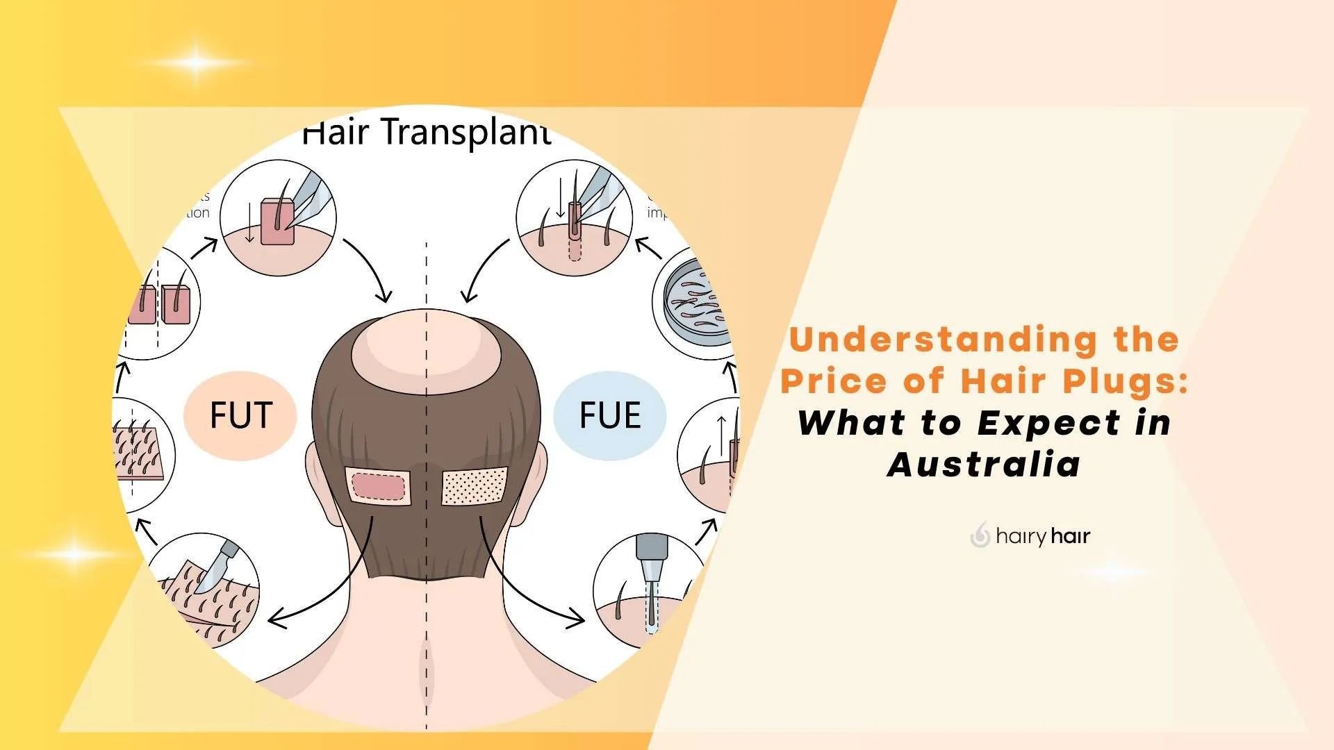 Understanding the Price of Hair Plugs: What to Expect in Australia