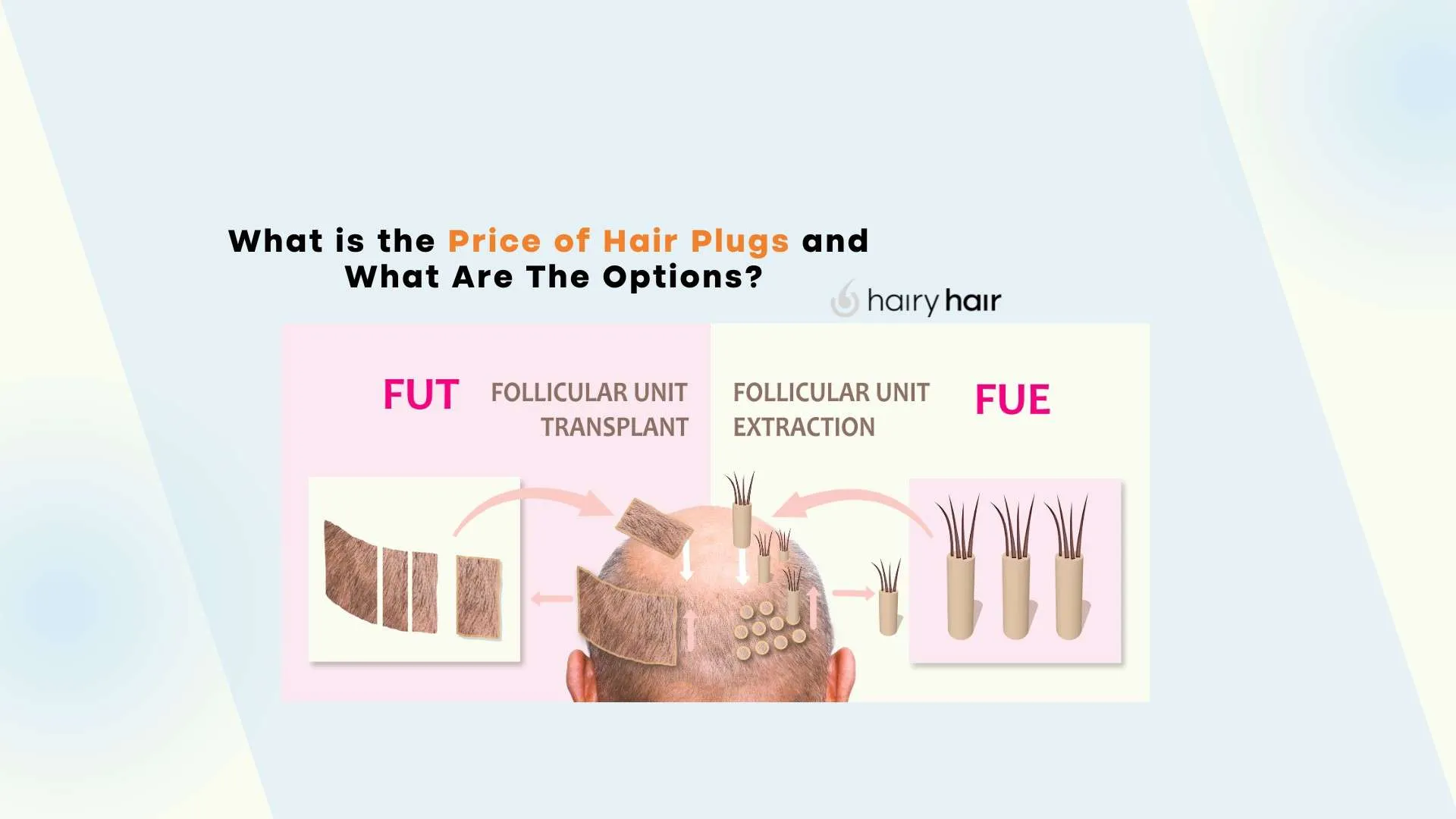 What is the Price of Hair Plugs and What Are The Options?