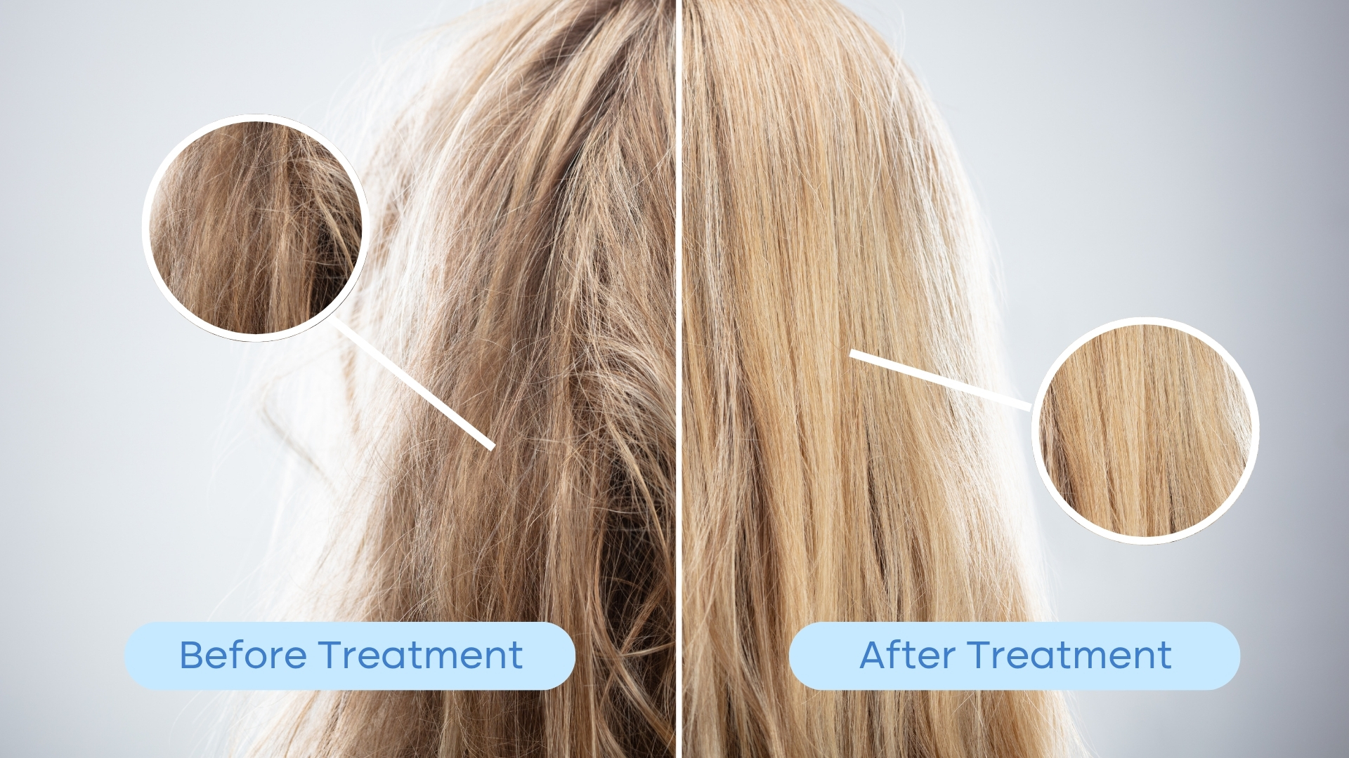 Understanding What is Nanoplasty Hair Treatment: A Comprehensive Guide